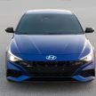 2021 Hyundai Elantra N Line – 1.6T, 201 hp, 264 Nm!