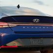 2021 Hyundai Elantra N Line – 1.6T, 201 hp, 264 Nm!