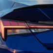 2021 Hyundai Elantra N Line – 1.6T, 201 hp, 264 Nm!