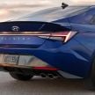 2021 Hyundai Elantra N Line – 1.6T, 201 hp, 264 Nm!