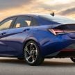 2021 Hyundai Elantra N Line – 1.6T, 201 hp, 264 Nm!