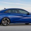 2021 Hyundai Elantra N Line – 1.6T, 201 hp, 264 Nm!