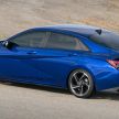 2021 Hyundai Elantra N Line – 1.6T, 201 hp, 264 Nm!