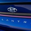 2021 Hyundai Elantra N Line – 1.6T, 201 hp, 264 Nm!